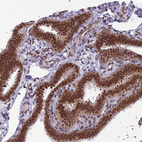 Immunohistochemical staining of human fallopian tube shows strong nuclear positivity in glandular cells.