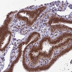 Immunohistochemical staining of human fallopian tube shows strong nuclear positivity in glandular cells.