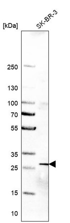 Western blot analysis in human cell line SK-BR-3.