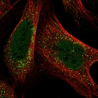 Immunofluorescent staining of human cell line U-2 OS shows localization to nucleoplasm & vesicles.