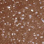 Immunohistochemical staining of human cerebral cortex shows strong cytoplasmic positivity in neuropil.