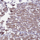Immunohistochemical staining of human heart muscle shows moderate cytoplasmic positivity in cardiomyocytes.