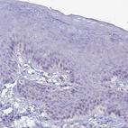 Immunohistochemical staining of human skin shows no positivity in keratinocytes.