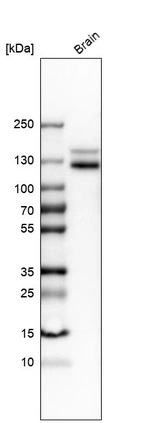 Western blot analysis in human brain tissue.