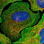 Immunofluorescent staining of human cell line U-2 OS shows localization to plasma membrane & cytosol.