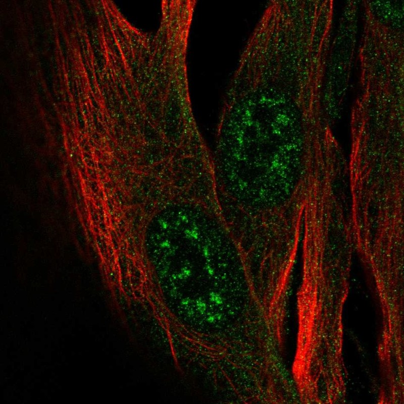 Anti-ZCWPW2 Antibody
