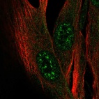 Anti-ZCWPW2 Antibody
