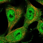 Immunofluorescent staining of human cell line U-251 MG shows localization to nucleoplasm & cytosol.