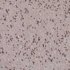 Immunohistochemical staining of human cerebral cortex shows strong nuclear positivity in glial cells.