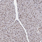 Immunohistochemical staining of human pancreas shows strong nuclear positivity in exocrine glandular cells.