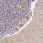 Anti-FAM149B1 Antibody
