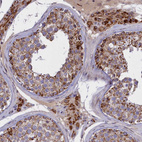 Immunohistochemical staining of human testis shows strong cytoplasmic positivity in Leydig cells and seminiferous duct cells.