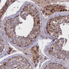 Immunohistochemical staining of human testis shows strong cytoplasmic positivity in Leydig cells and seminiferous duct cells.