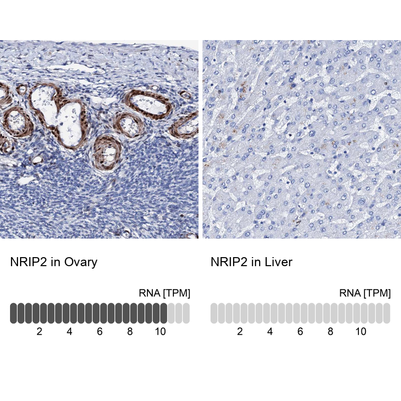 Anti-NRIP2 Antibody