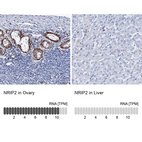 Anti-NRIP2 Antibody