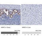Anti-NRIP2 Antibody
