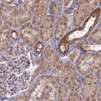 Immunohistochemical staining of human kidney shows moderate cytoplasmic positivity in cells in tubules.