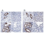 Immunohistochemical staining of human colon, liver, ovary and testis using Anti-NRIP2 antibody HPA039860 (A) shows similar protein distribution across tissues to independent antibody HPA039197 (B).