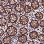 Immunohistochemical staining of human Colon shows strong cytoplasmic positivity in glandular cells.