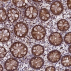 Immunohistochemical staining of human Colon shows strong cytoplasmic positivity in glandular cells.