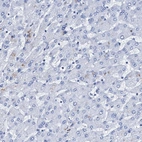 Immunohistochemical staining of human liver shows low expression as expected.