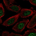Immunofluorescent staining of human cell line PC-3 shows localization to nucleoplasm.
