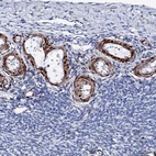 Immunohistochemical staining of human ovary shows high expression.