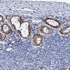 Immunohistochemical staining of human ovary shows high expression.