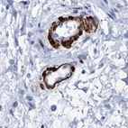 Immunohistochemical staining of human colon using Anti-NRIP2 antibody HPA039860.