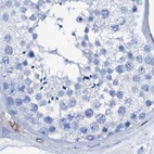Immunohistochemical staining of human testis using Anti-NRIP2 antibody HPA039860.