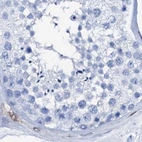 Immunohistochemical staining of human testis using Anti-NRIP2 antibody HPA039860.
