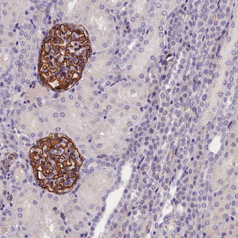 Anti-KLHL35 Antibody