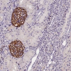 Anti-KLHL35 Antibody