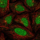 Immunofluorescent staining of human cell line SiHa shows localization to nucleus, nucleoli fibrillar center & centrosome.