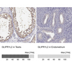 Anti-GLIPR1L2 Antibody