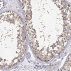 Immunohistochemical staining of human testis shows high expression.