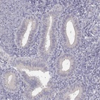 Anti-GLIPR1L2 Antibody