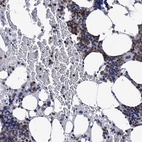 Immunohistochemical staining of human bone marrow shows high expression.