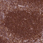Anti-SIPA1 Antibody