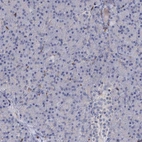 Immunohistochemical staining of human pancreas shows low expression as expected.