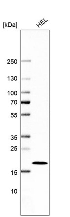 Western blot analysis in human cell line HEL.