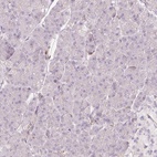 Immunohistochemical staining of human pancreas shows low expression as expected.