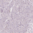Anti-SIPA1 Antibody