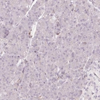 Immunohistochemical staining of human pancreas shows low expression as expected.