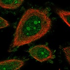 Immunofluorescent staining of human cell line PC-3 shows localization to nucleoli & plasma membrane.