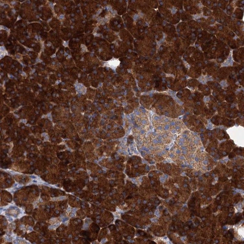 Anti-ALKBH7 Antibody