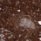 Anti-ALKBH7 Antibody