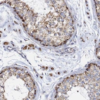 Immunohistochemical staining of human testis shows strong granular cytoplasmic positivity in Leydig cells and cells in seminiferous ducts.