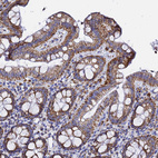Immunohistochemical staining of human colon shows strong granular cytoplasmic positivity in glandular cells.