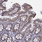 Immunohistochemical staining of human colon shows strong granular cytoplasmic positivity in glandular cells.